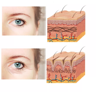 肌肤衰老原因